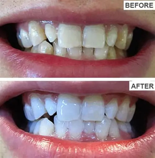 Advanced Purple Color Correcting Strips